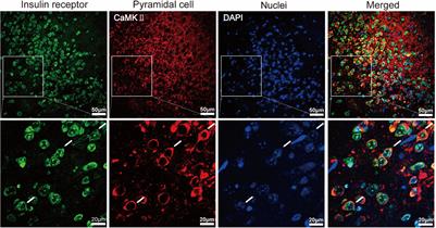 Insulin Modulates Neural Activity of Pyramidal Neurons in the Anterior <mark class="highlighted">Piriform Cortex</mark>